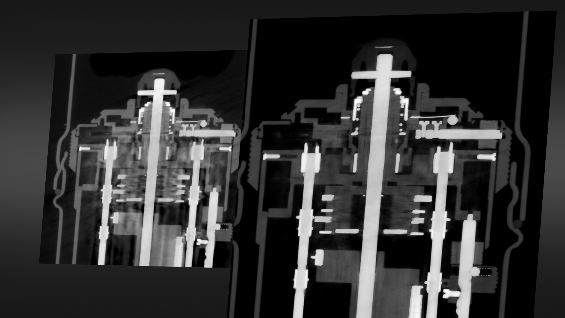 Réduction avancée des artefacts liés aux matériaux mixtes (AMMAR)