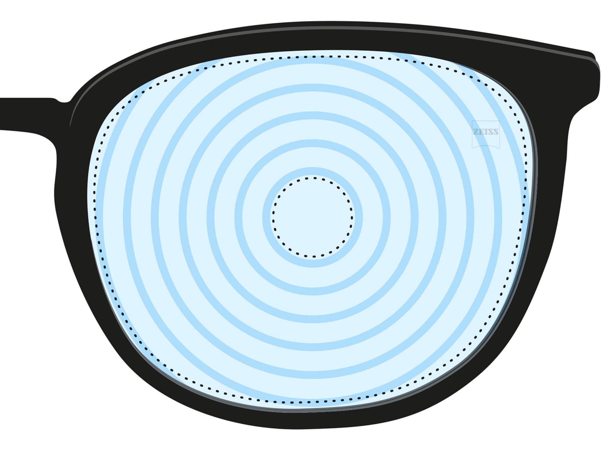 Een illustratie van een brillenglas voor myopiebeheer. Het heeft concentrische cirkels die verschillende brillenglasvermogens voorstellen. Het is een voorbeeld van een brillenglasdesign voor gespecialiseerde doeleinden.